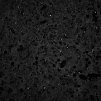astrocytes__michela project thumbnail