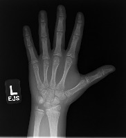 Dataset Image