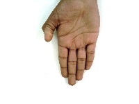 hand-dectection project thumbnail