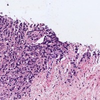 New_Prostate_Histopathology project thumbnail