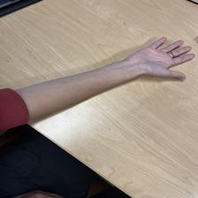 bug bite - Roboflow Universe