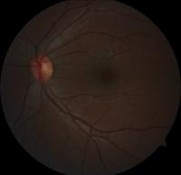Dataset Image