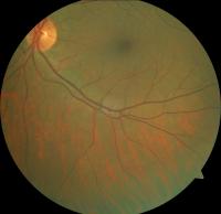 Dataset Image