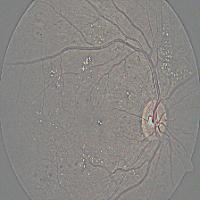 Dataset Image