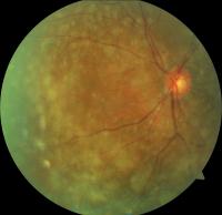 Dataset Image