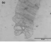 MicroScan AI project thumbnail