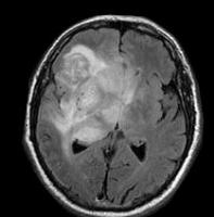 Medical image segmentation Instance Segmentation Dataset by Sreeram