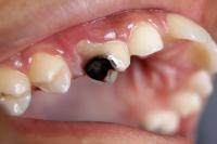 cavity project thumbnail