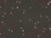 Sperm tracing project thumbnail