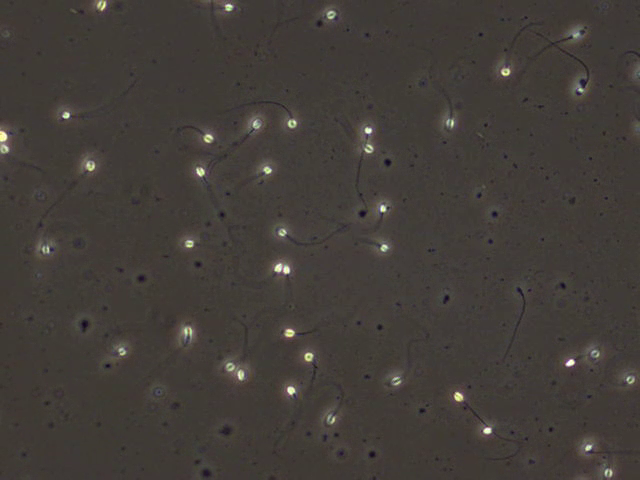 Sperm Detection SPERM - Nhi Test Object Detection Dataset by Sperm analysis