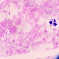 allParasites_Wbc project thumbnail