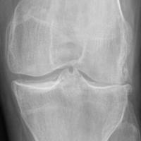 Find joints and bones project thumbnail