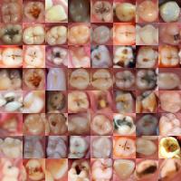 best augmented real image dataset project thumbnail