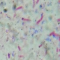 Bacteria_Detection_EColi_Vibrio project thumbnail