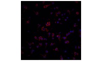 t-cell project thumbnail