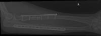 Manual-labeling-train-data 2 project thumbnail
