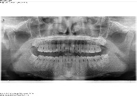 BINE1 OBJECT project thumbnail