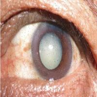 eye project thumbnail