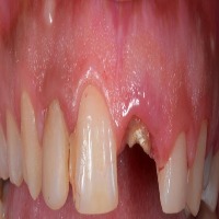 Teeth Health project thumbnail