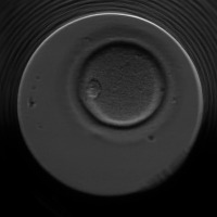 oocyte project thumbnail