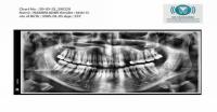 Oral panoramic object detection project thumbnail