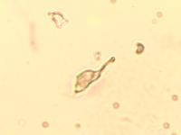 NEURONS detection project thumbnail