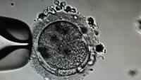 ICSI_Detection project thumbnail