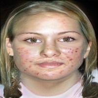 face regions detection project thumbnail