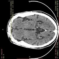 Brain_Data project thumbnail