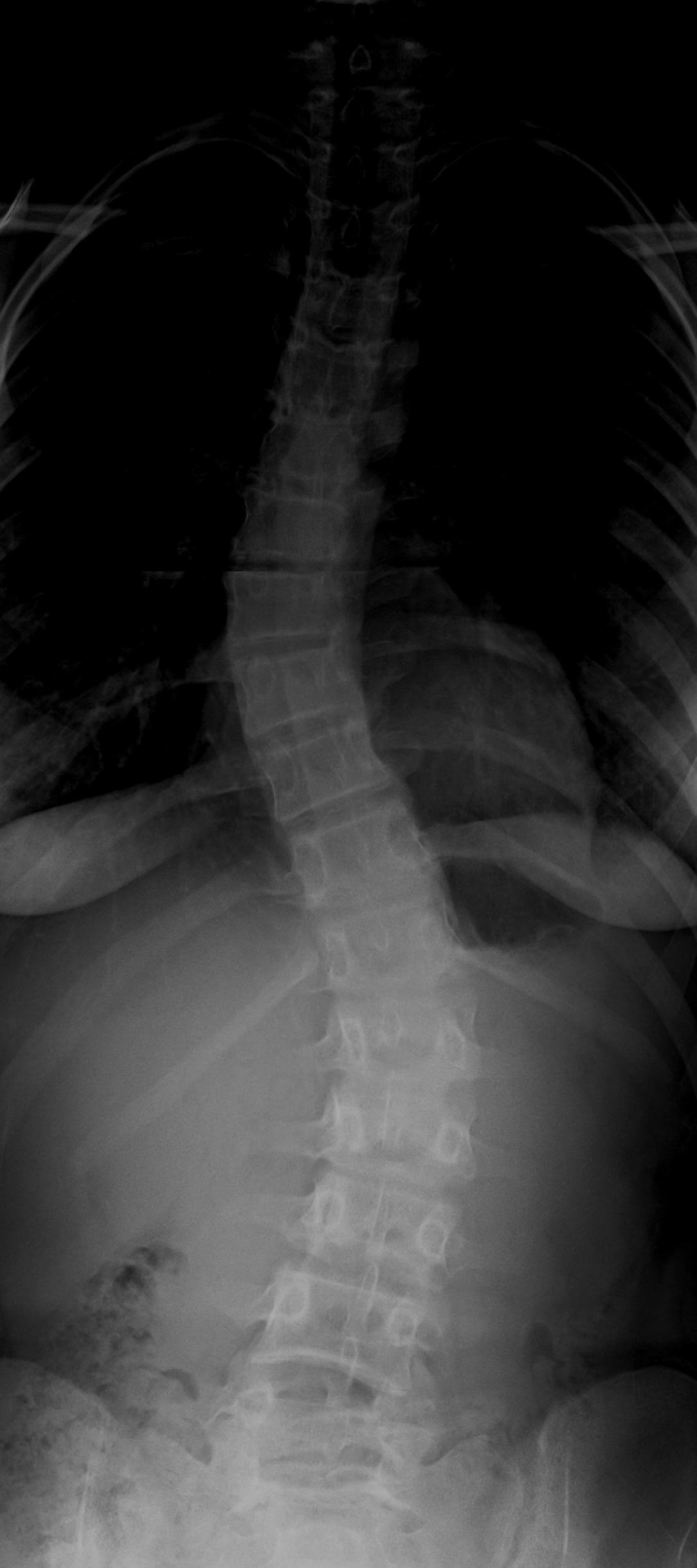 Bone Object Detection Dataset by Bone