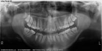 Dental X-Ray Detailed 2 project thumbnail