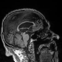 sagittal project thumbnail