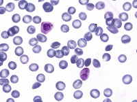 Plasmodium Vivax project thumbnail