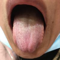tongue  project thumbnail