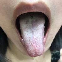 Dr. Tounge project thumbnail