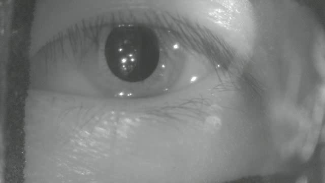 EYE Object Detection Dataset by cheese G