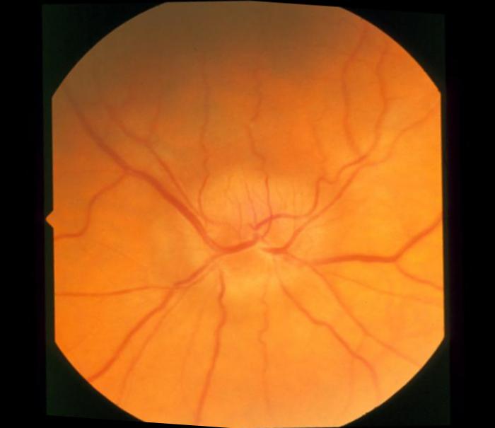 malignant Classification Dataset by Special Problem