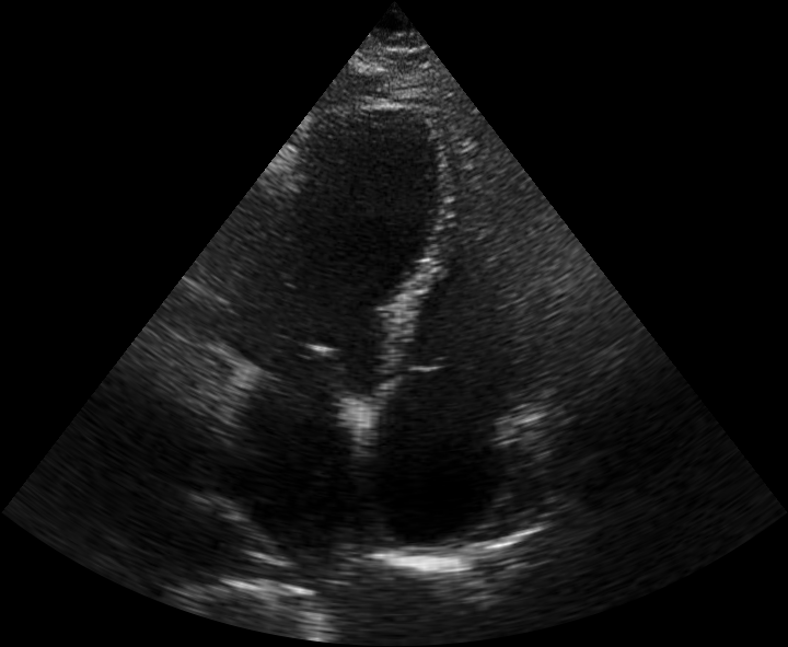 Cardiac Instance Segmentation Model by TestYolo