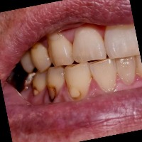 ToothCariesAI project thumbnail