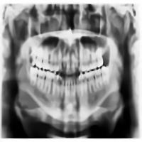 dataset_20_2ndpre project thumbnail