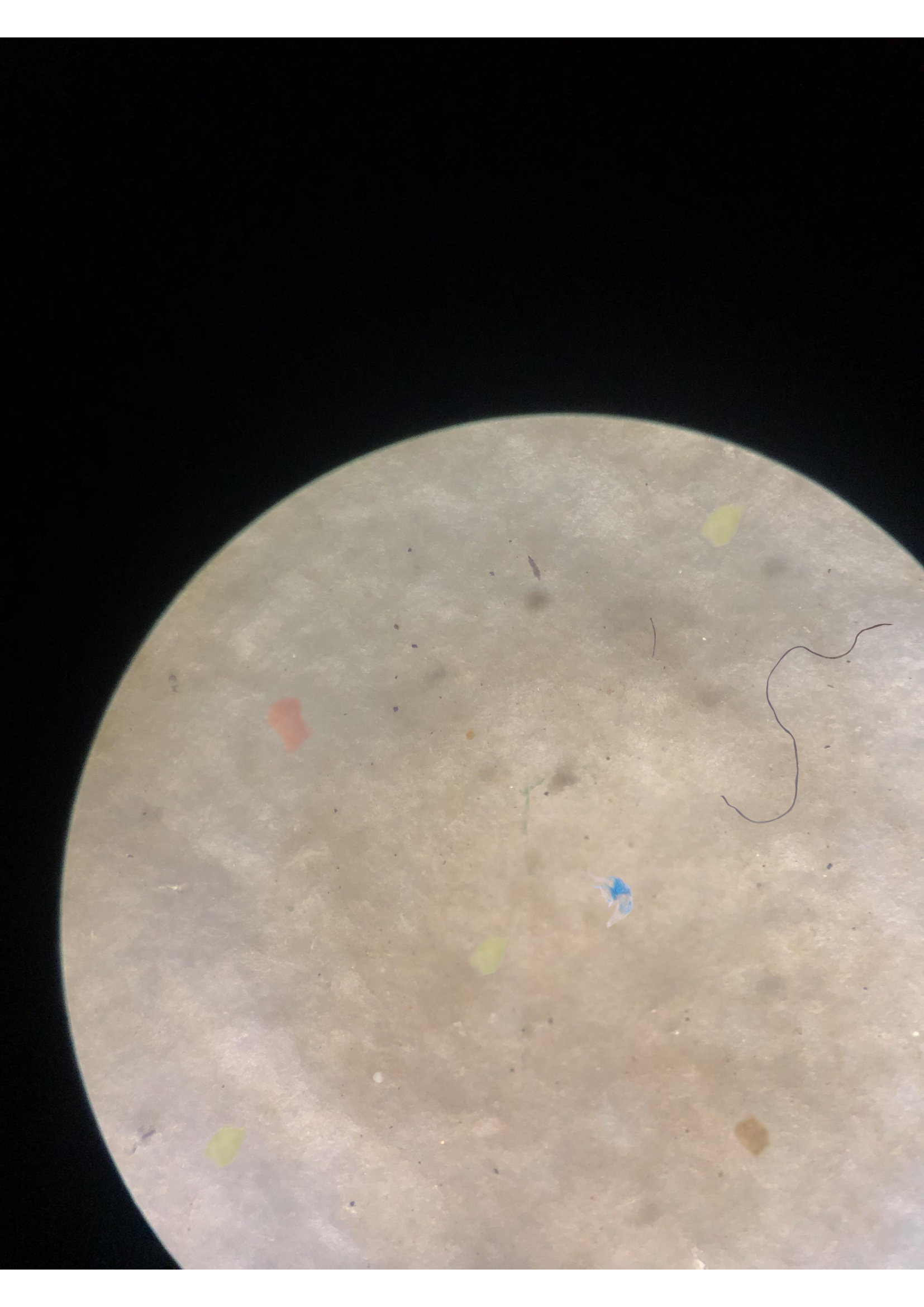 microplastic_100 Object Detection Dataset by microplastic