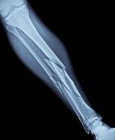 Find broken bones 4 project thumbnail