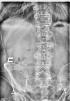 vertebra1 project thumbnail
