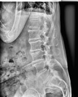 Find thoracic spine project thumbnail