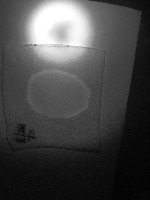 Semen Stain Detection project thumbnail