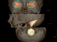 Classification of CT image project thumbnail
