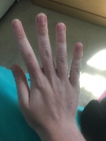 Hand detection project thumbnail