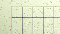 Sperm_1s2f_4part_2 project thumbnail