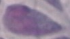Herlev-Cervical-Cells project thumbnail