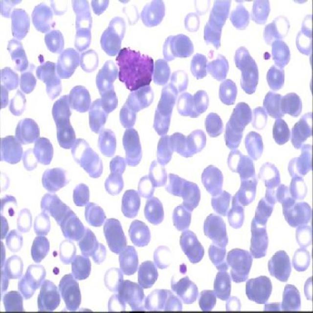 Cell Classification Object Detection Dataset By Work